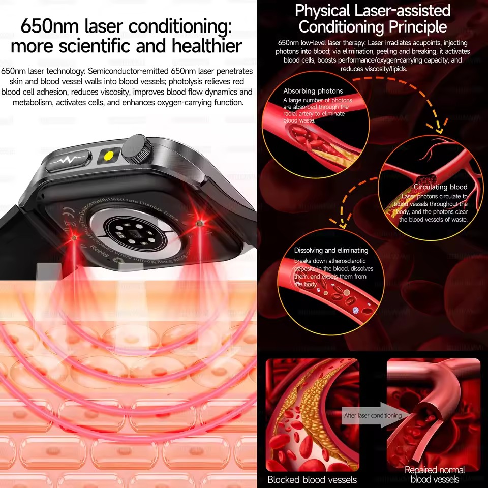 2026年新型健康スマートウォッチ、レーザー療法で高血圧、高 - Industrial Laser Temperature のレビューと価格